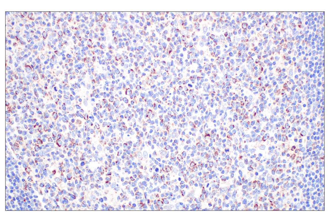 Immunohistochemistry Image 6: GCDH (F2P2M) Rabbit Monoclonal Antibody