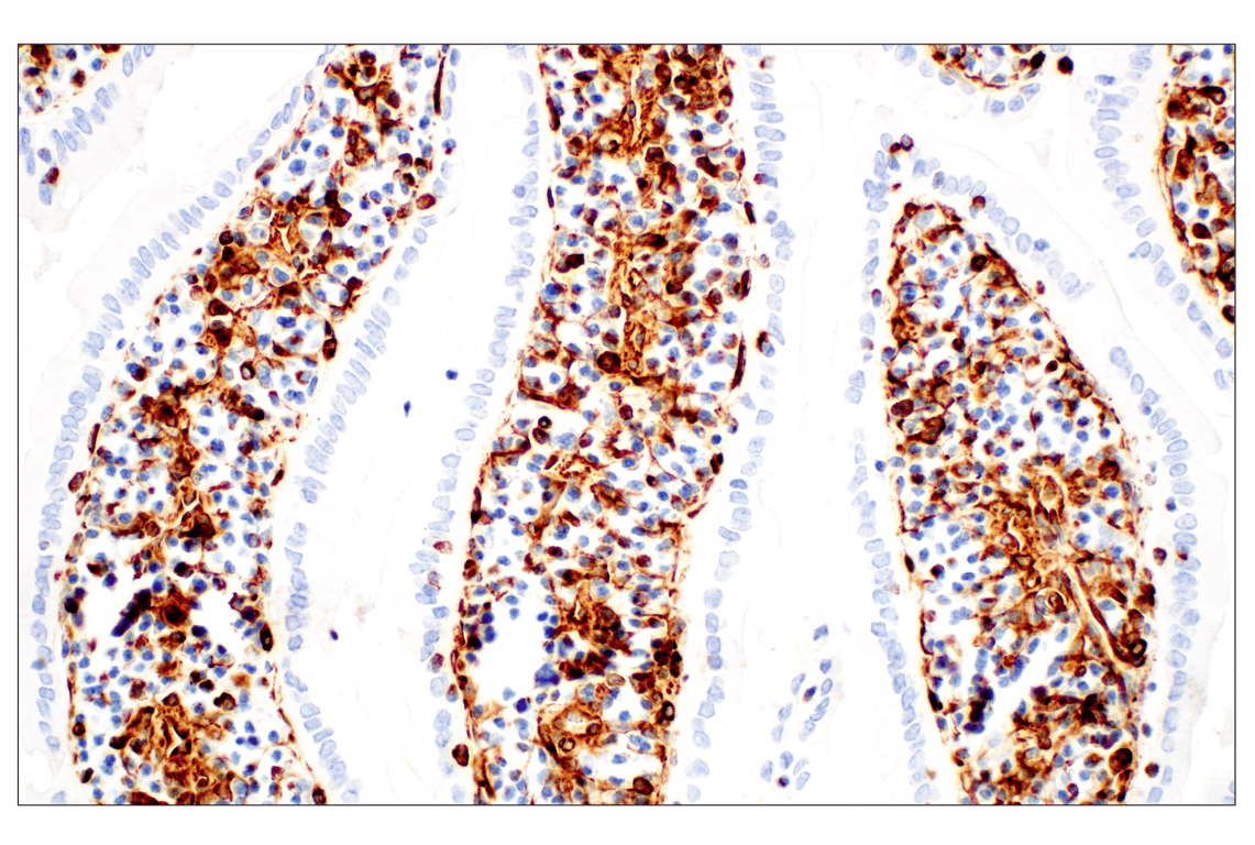 Immunohistochemistry Image 5: Vimentin (D21H3) Rabbit Monoclonal Antibody (BSA and Azide Free)