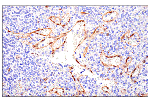 Immunohistochemistry Image 3: TAZ (E9J5A) Rabbit Monoclonal Antibody (BSA and Azide Free)