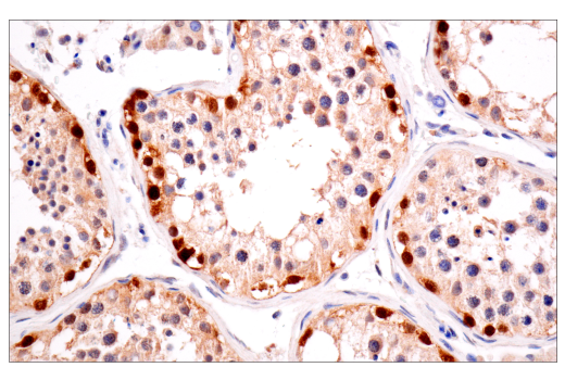 Immunohistochemistry Image 8: VHL (E3X9K) Rabbit Monoclonal Antibody