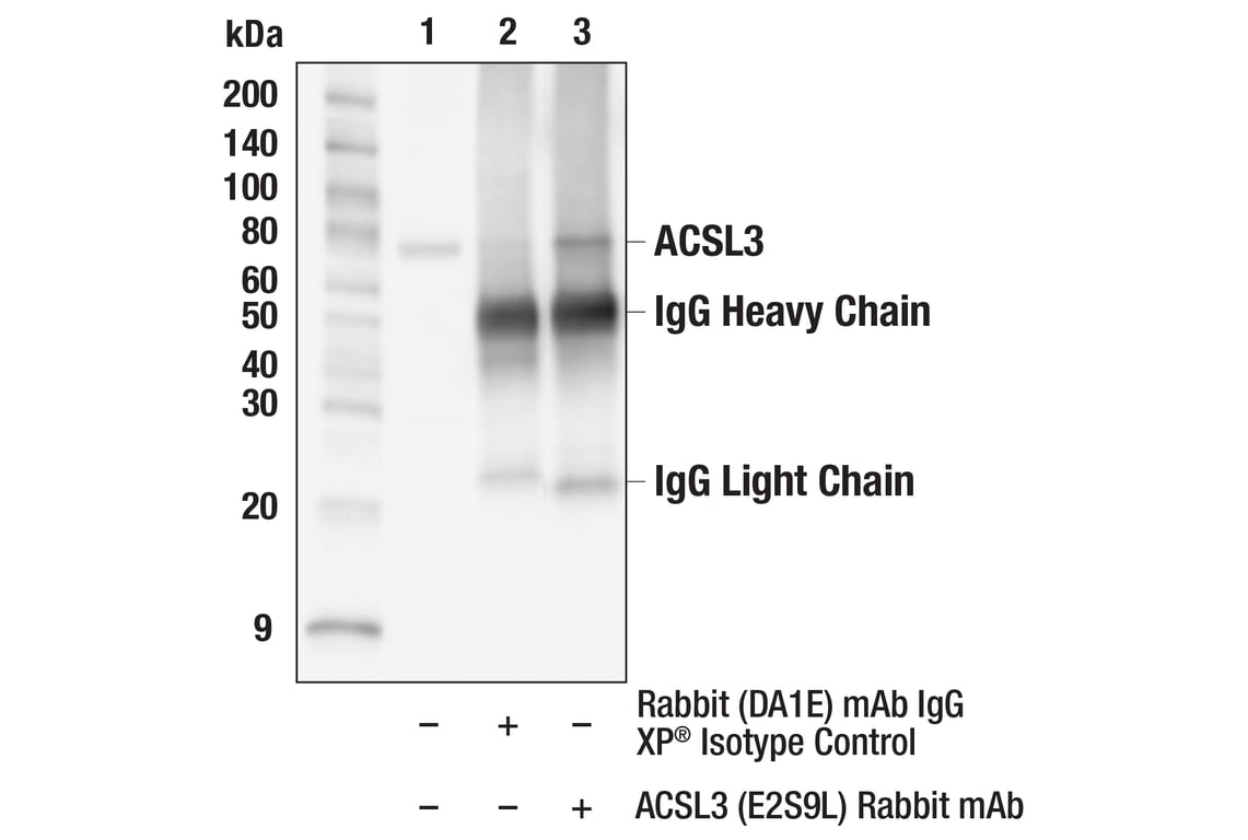 Immunoprecipitation Image 1: ACSL3 (E2S9L) Rabbit Monoclonal Antibody
