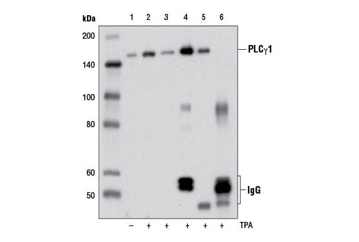 undefined Image 14: Angiogenesis Antibody Sampler Kit