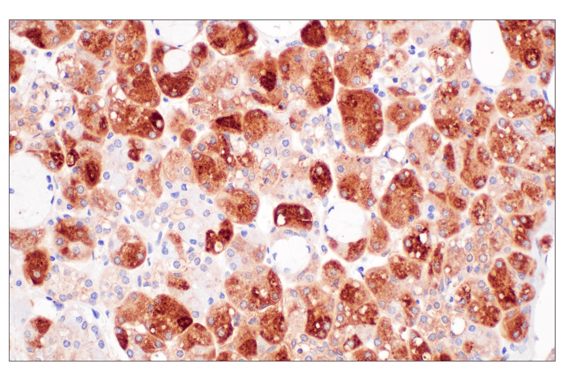 Immunohistochemistry Image 4: Desmoplakin (F3J8Y) Rabbit Monoclonal Antibody
