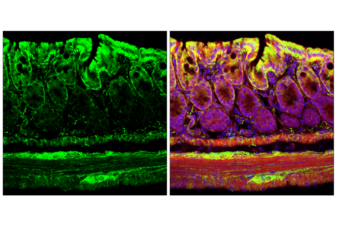 Immunofluorescence Image 1: Hexokinase I (C35C4) Rabbit Monoclonal Antibody (BSA and Azide Free)