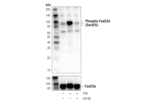 Western Blotting Image 1: Phospho-FoxO3a (Ser425) (D5E9T) Rabbit mAb