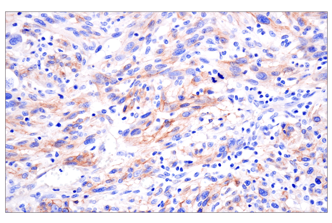 Immunohistochemistry Image 3: LRRC15 (E4X8J) Rabbit Monoclonal Antibody