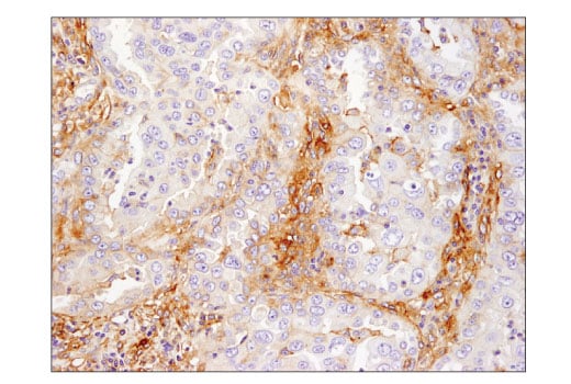Immunohistochemistry Image 1: B7-H3 (D9M2L) Rabbit Monoclonal Antibody