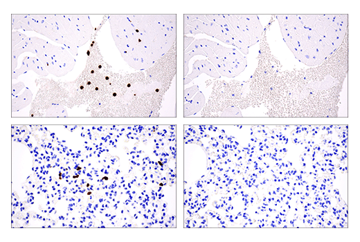 Immunohistochemistry Image 5: S100A8 (E4F8V) Rabbit Monoclonal Antibody (BSA and Azide Free)