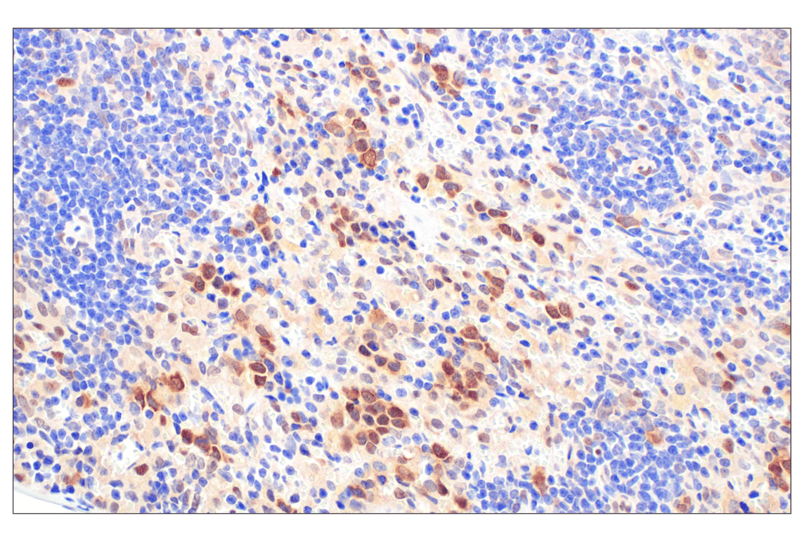 Immunohistochemistry Image 5: CDK4 (F8L5F) Rabbit Monoclonal Antibody