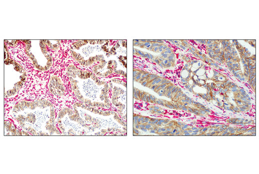 Immunohistochemistry Image 2: SignalStain<sup>®</sup> Vibrant Red Alkaline Phosphatase Substrate Kit