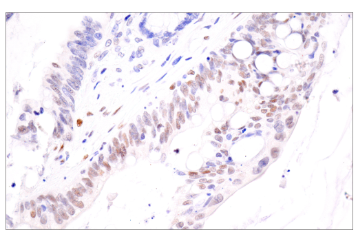 Immunohistochemistry Image 4: HIF-1α (E1V6A) Rabbit mAb (BSA and Azide Free)