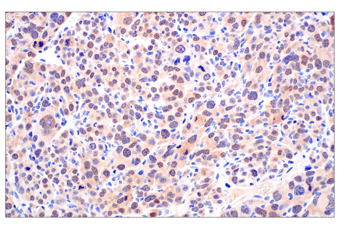 Immunohistochemistry Image 7: PIP4K2C (E7P3S) Rabbit Monoclonal Antibody