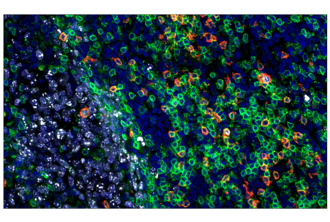 Immunohistochemistry Image 3: CD3 epsilon (D7A6E) Rabbit Monoclonal Antibody (Alexa Fluor<sup>®</sup> 488 Conjugate)