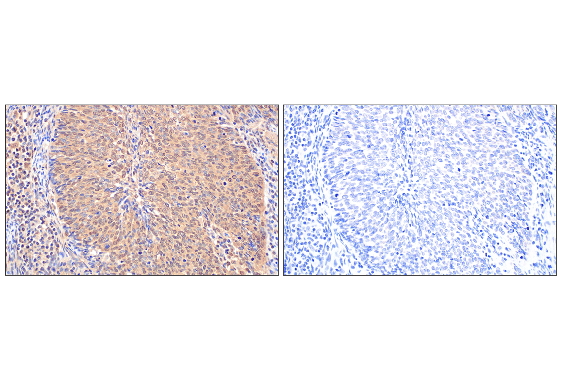 Immunohistochemistry Image 11: MTAP (E5R1I) Rabbit Monoclonal Antibody