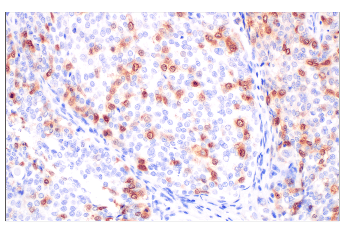 Immunohistochemistry Image 5: Thymidine Kinase 1 (E2H7Z) Rabbit Monoclonal Antibody