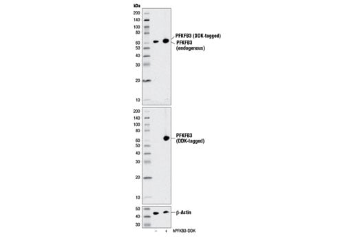 undefined Image 10: Glycolysis II Antibody Sampler Kit