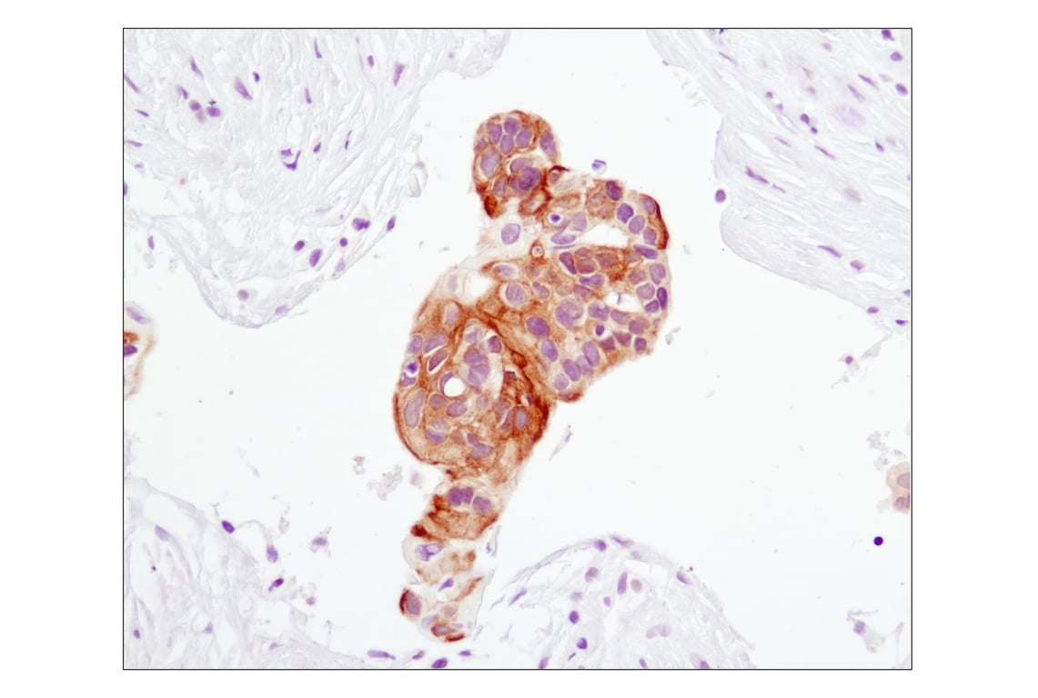 Immunohistochemistry Image 1: Phospho-Akt (Ser473) (D9E) Rabbit Monoclonal Antibody