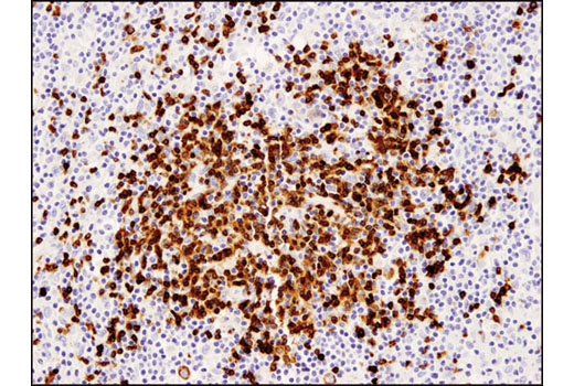 Immunohistochemistry Image 1: CD79A (D1X5C) Rabbit Monoclonal Antibody (BSA and Azide Free)