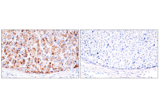 Immunohistochemistry Image 2: AFP (C3) Mouse Monoclonal Antibody