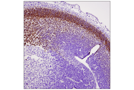 Immunohistochemistry Image 3: TBR1 (D6C6X) Rabbit Monoclonal Antibody
