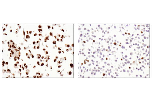 Immunohistochemistry Image 2: NCoR1 (E4S4N) Rabbit Monoclonal Antibody