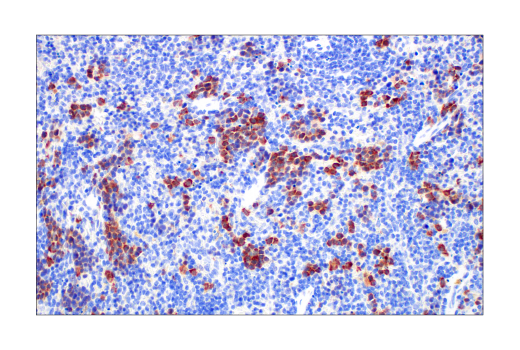 Immunohistochemistry Image 6: Asparagine Synthetase (E6C2C) Rabbit Monoclonal Antibody (BSA and Azide Free)