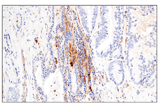 Immunohistochemistry Image 4: CD54/ICAM-1 (E3Q9N) XP<sup>®</sup> Rabbit mAb