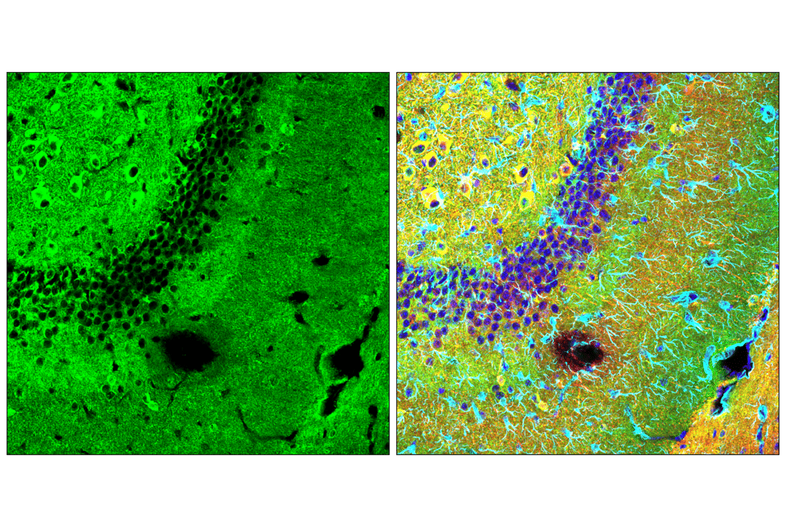 Immunofluorescence Image 2: Phospho-Tau (Thr205) (E9A7P) Mouse Monoclonal Antibody