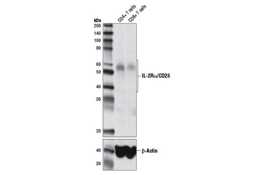 Western Blotting Image 2: IL-2Rα/CD25 (D6K5F) Rabbit mAb