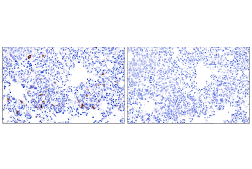Immunohistochemistry Image 5: IL-2R alpha/CD25 (E9W2J) Rabbit Monoclonal Antibody