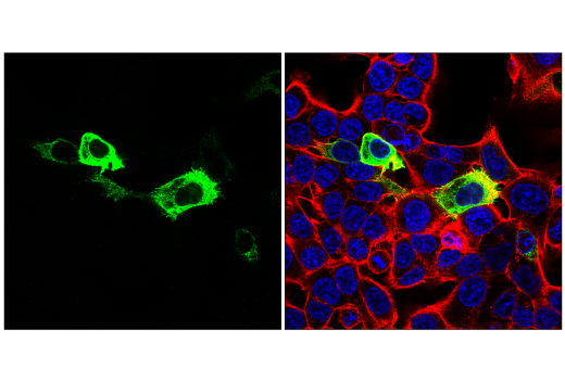 SARS-CoV-2 Spike Protein (RBD) (E7B3E) Rabbit mAb | Cell