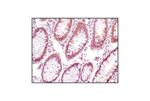 Immunohistochemistry Image 2: PTEN (D4.3) Rabbit Monoclonal Antibody (BSA and Azide Free)