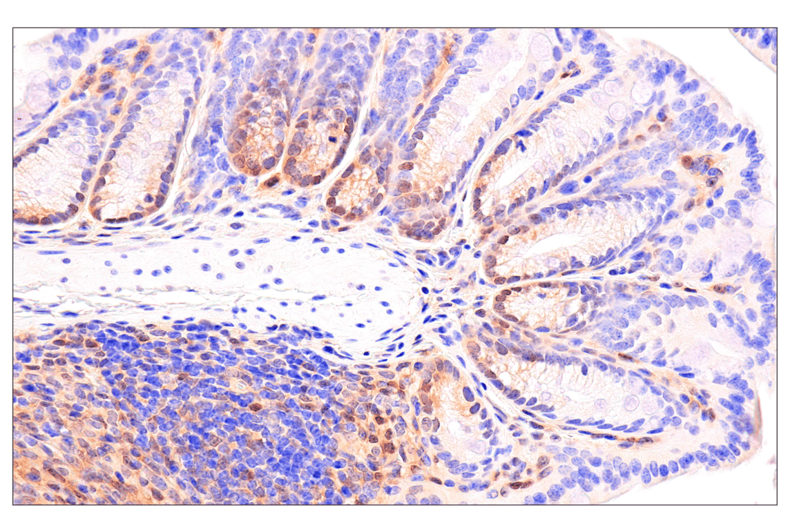 Immunohistochemistry Image 9: CDK6 (E3E3Q) Rabbit Monoclonal Antibody