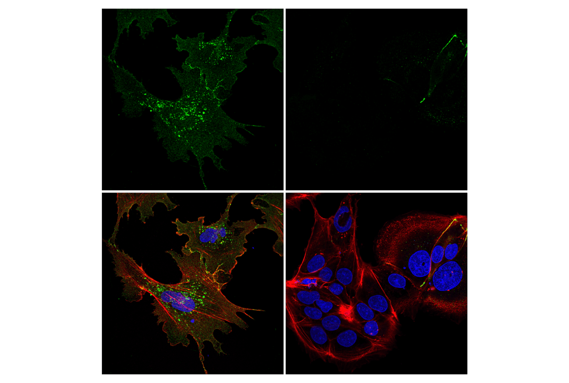 Immunofluorescence Image 1: Connexin 43 (E7N2R) Rabbit Monoclonal Antibody (BSA and Azide Free)