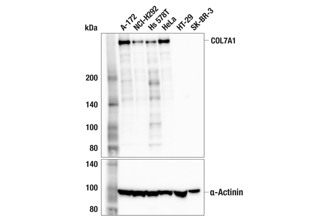 Western Blotting Image 2: COL7A1 (F4Q8A) Rabbit Monoclonal Antibody