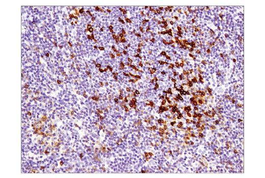 Immunohistochemistry Image 2: PD-1 (Intracellular Domain) (D4W2J) XP<sup>®</sup> Rabbit mAb (BSA and Azide Free)