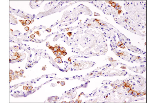 Immunohistochemistry Image 3: TIM-3 (D5D5R<sup>™</sup>) Rabbit Monoclonal Antibody
