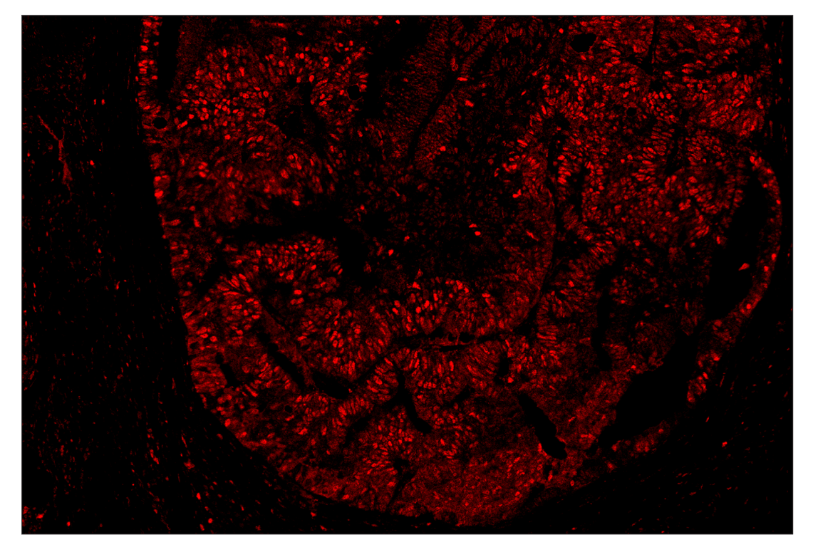 Immunohistochemistry Image 1: PCNA (D3H8P) & CO-0090-647 SignalStar<sup>™</sup> Oligo-Antibody Pair