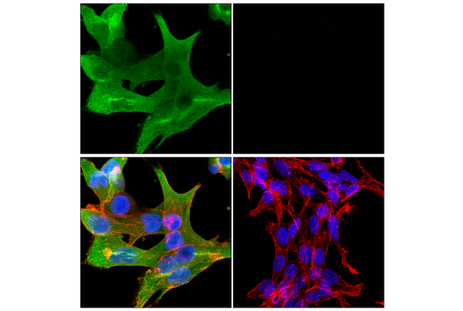 Immunofluorescence Image 1: Galectin-3/LGALS3 (E7B6R) Rabbit Monoclonal Antibody