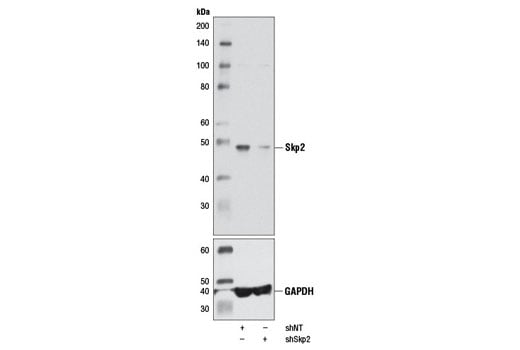 Western Blotting Image 3: Skp2 (D3G5) Rabbit Monoclonal Antibody