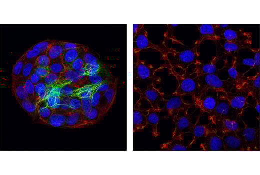 Immunofluorescence Image 1: Keratin 18 (DC10) Mouse Monoclonal Antibody (BSA and Azide Free)