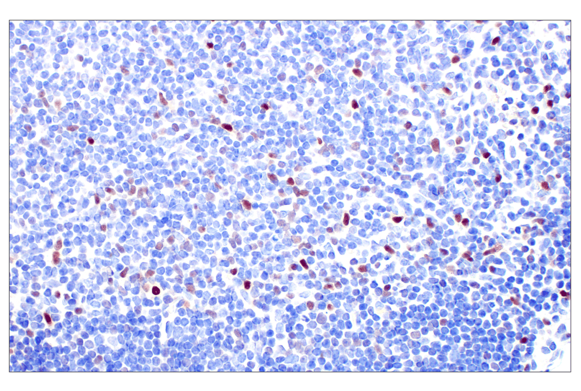 Immunohistochemistry Image 6: T-bet/TBX21 (E4I2K) Rabbit Monoclonal Antibody (BSA and Azide Free)