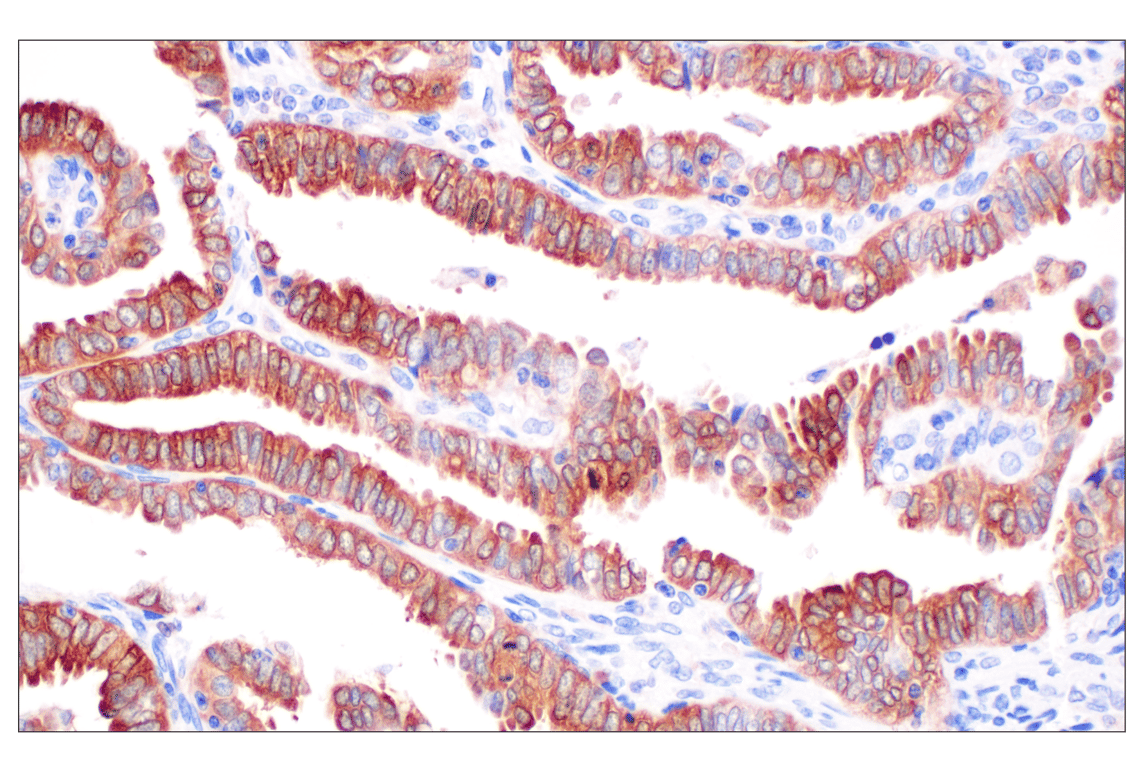 Immunohistochemistry Image 3: SHMT1 (F5Q3S) Rabbit Monoclonal Antibody