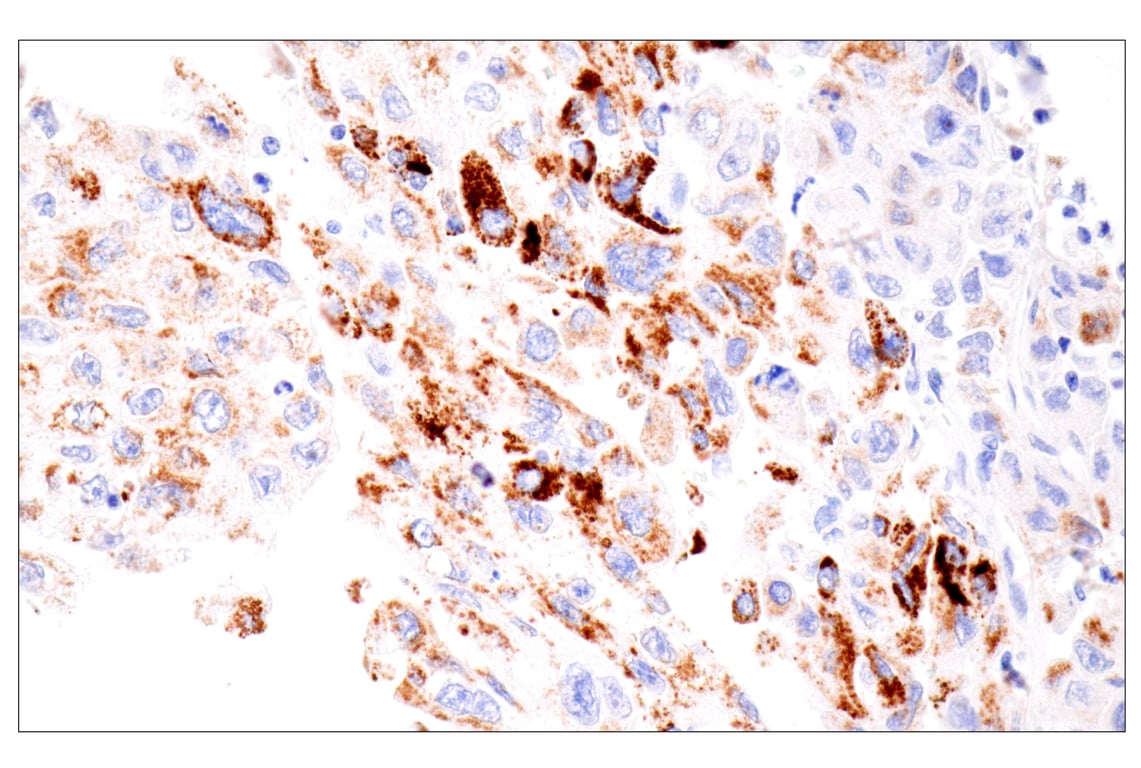 Immunohistochemistry Image 2: CPS1/Hep Par-1 (OCH1E5) Mouse Monoclonal Antibody (Clone previously known as Hepatocyte Specific Antigen)