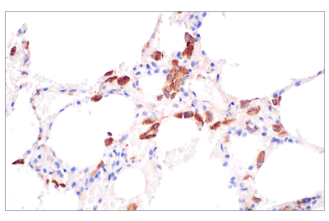 Immunohistochemistry Image 3: GLIPR2 (F7H7V) Rabbit Monoclonal Antibody