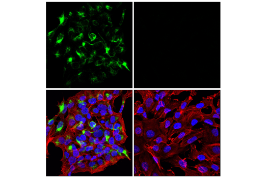 Immunofluorescence Image 1: Neurofilament-M (E7Y8W) Mouse Monoclonal Antibody (BSA and Azide Free)