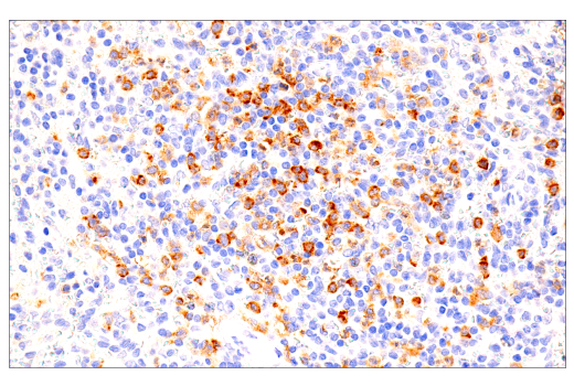 Immunohistochemistry Image 6: GM-CSF Receptor alpha (E8Z3S) Rabbit Monoclonal Antibody