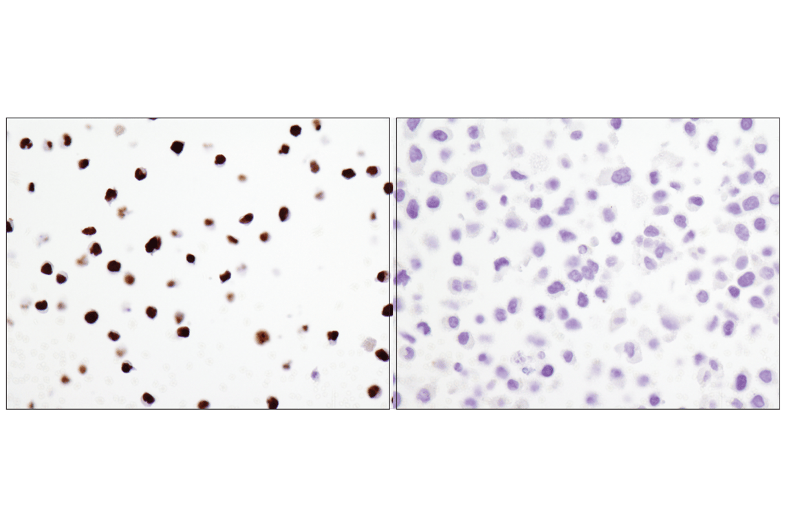 Immunohistochemistry Image 5: PAX5 (D7H5X) Rabbit Monoclonal Antibody (BSA and Azide Free)