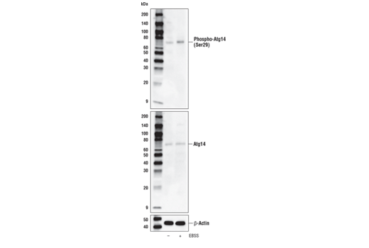 Western Blotting Image 4: Phospho-Atg14 (Ser29) (D4B8M) Rabbit Monoclonal Antibody