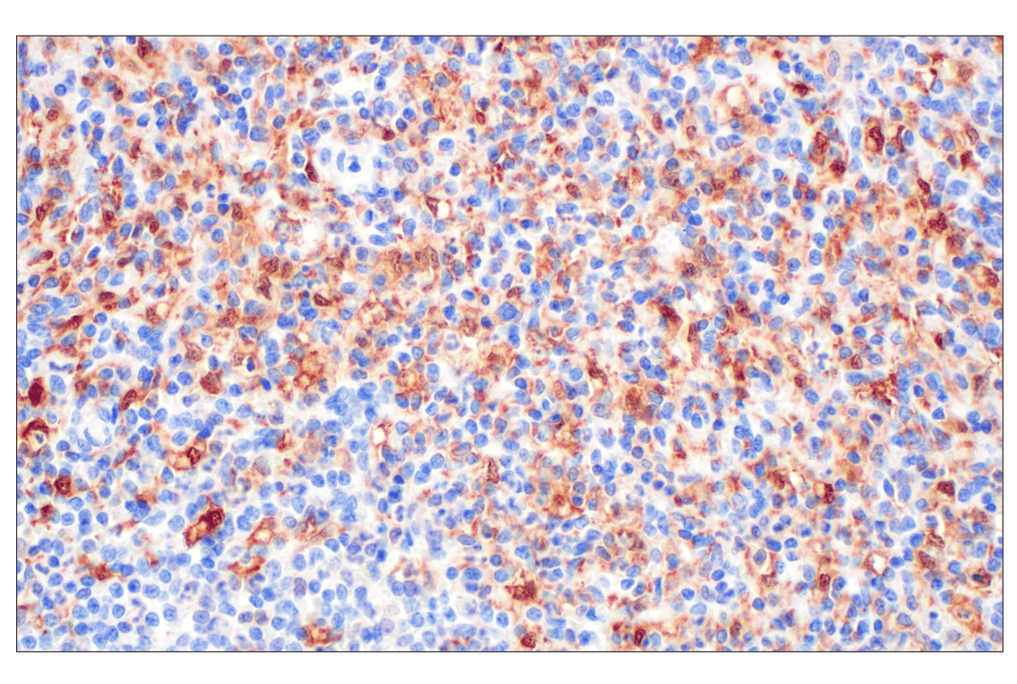Immunohistochemistry Image 4: BLVRA (F7Z7R) Rabbit Monoclonal Antibody